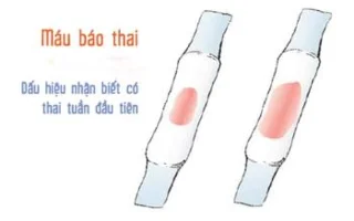 임신보고에서 생리혈 냄새가 나나요?-의사의 답변