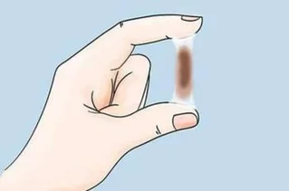 Brauner Ausfluss während der 39. Schwangerschaftswoche ist ein Zeichen für die Geburt?