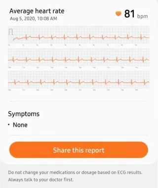 Cara memeriksa EKG di Samsung Galaxy Watch