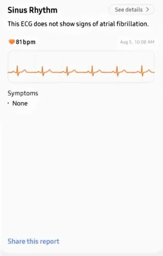 Cara memeriksa EKG di Samsung Galaxy Watch