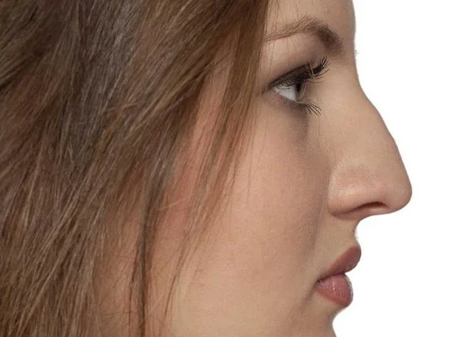 การแต่งหน้าจมูก: การแต่งหน้าที่ถูกต้องสำหรับทุกรูปร่าง