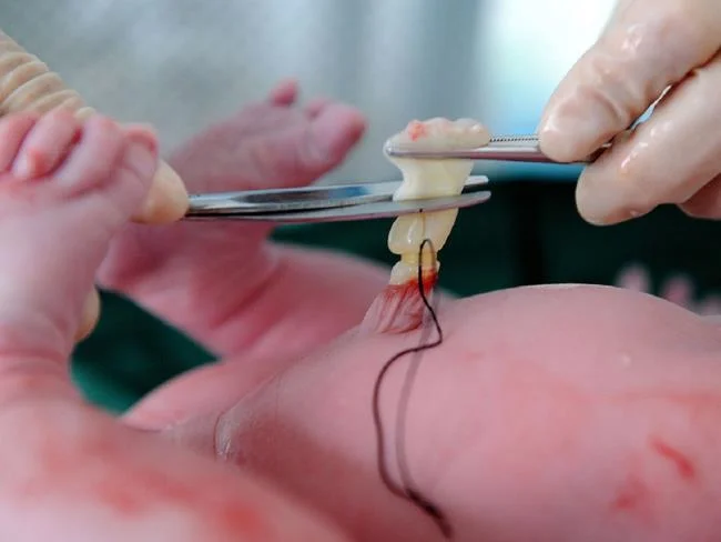 10 Dinge, die Sie über die Lagerung von Nabelschnurblut für Babys wissen sollten