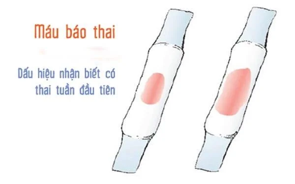 임신보고에서 생리혈 냄새가 나나요?-의사의 답변