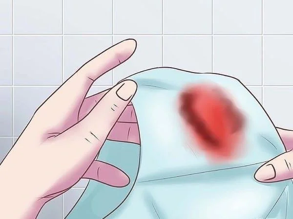 임신보고에서 생리혈 냄새가 나나요?-의사의 답변
