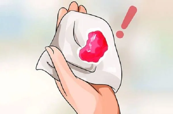 임신보고에서 생리혈 냄새가 나나요?-의사의 답변