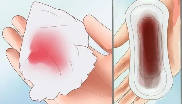 임신 보고서는 어떤 색입니까?  생리 혈색 같나요?