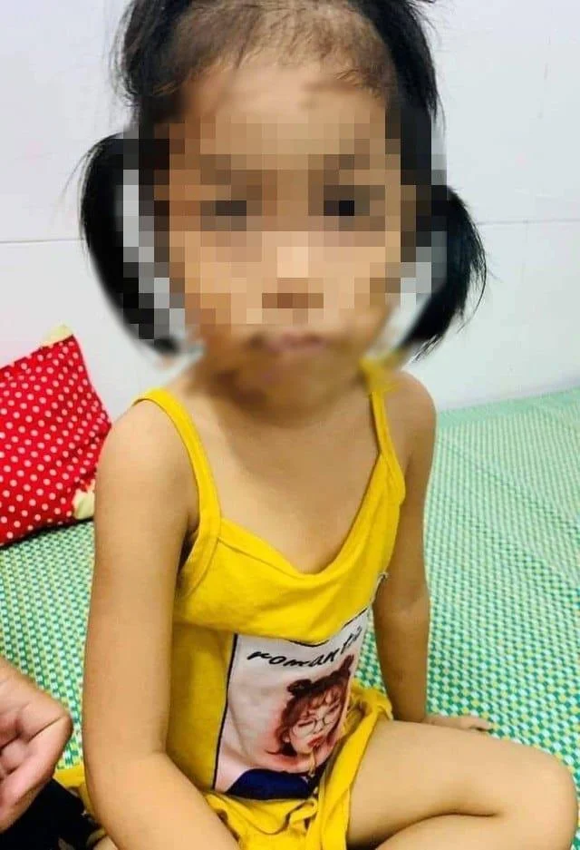 3 개월 된 아기가 중독되었고 가족이이 약을 사용하여 코를 흘 렸기 때문에 심장 충격을 받았습니다.