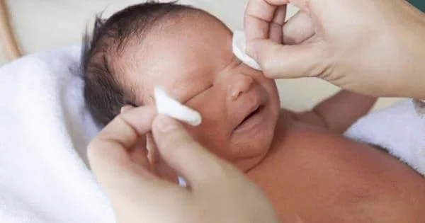 어린이의 눈이 붓는 7가지 원인 및 가정 요법