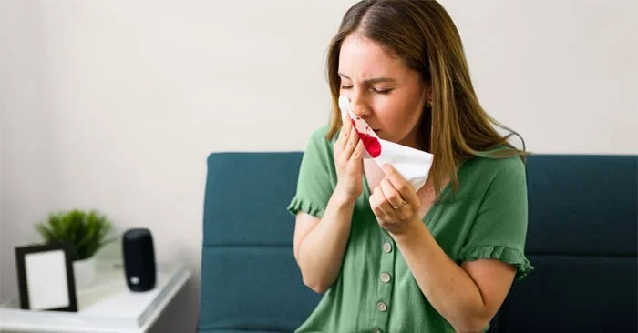 ¿Qué es la enfermedad de hemorragia nasal espontánea?