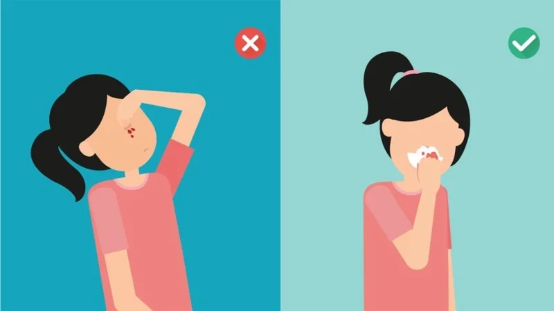 ¿Qué es la enfermedad de hemorragia nasal espontánea?