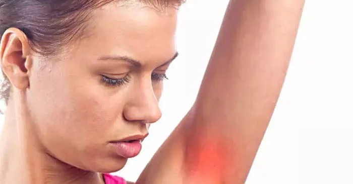 Coceira nas axilas é um sinal de alerta de câncer?